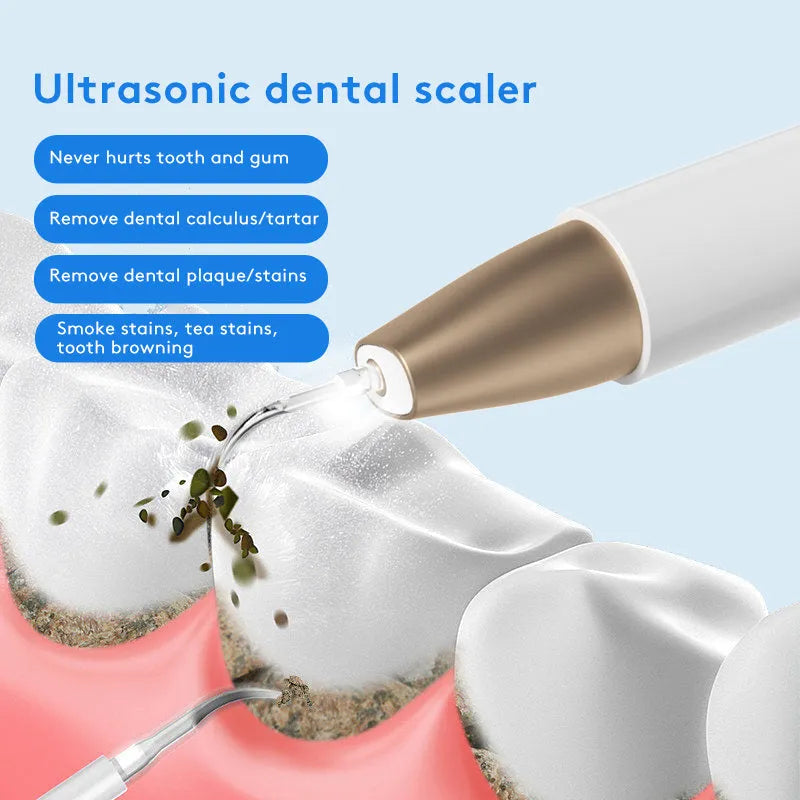 Gold ultrasonic tooth cleaning instrument for tartar removal and stain reduction