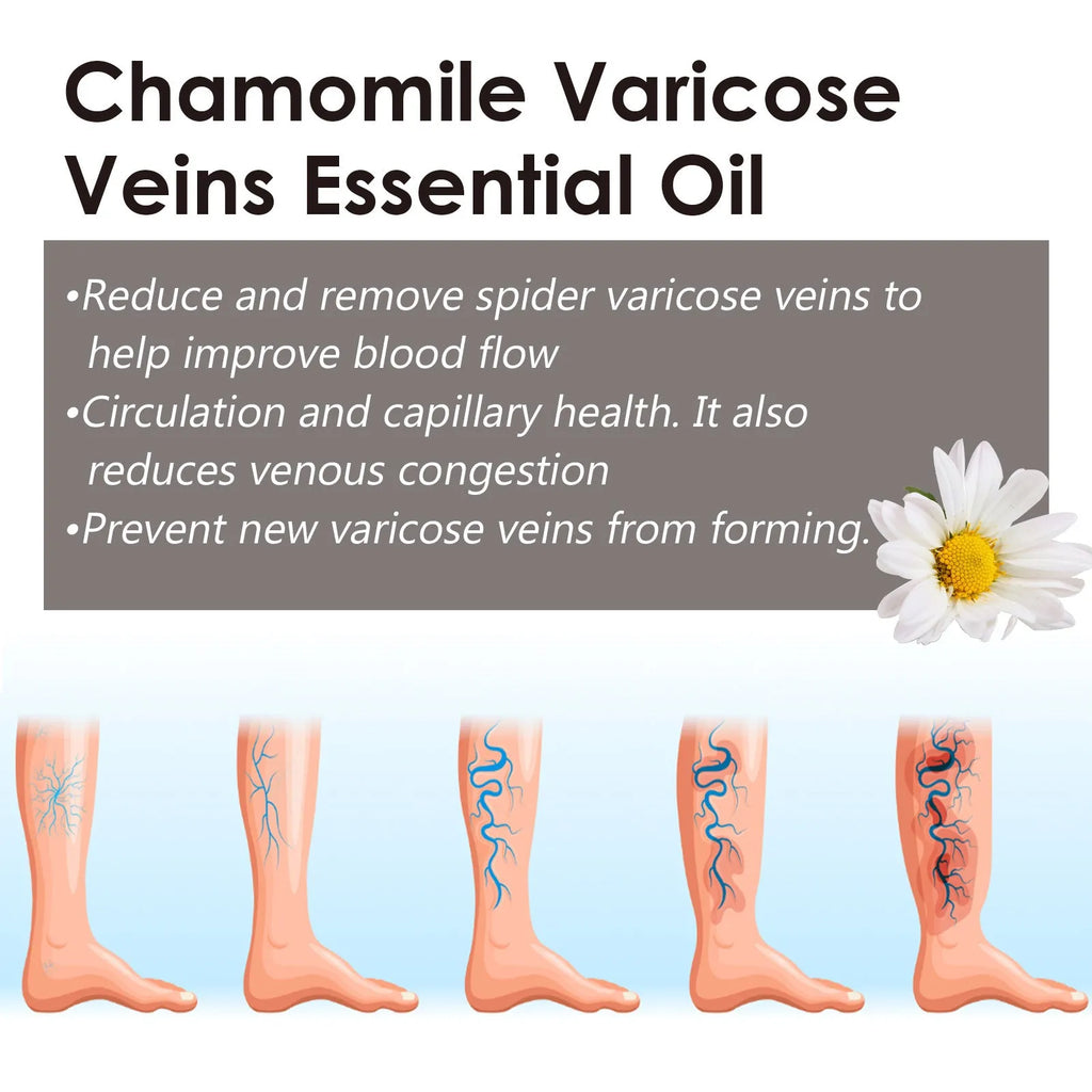 Chamomile essential oil bottle for leg care and massage, 10ml volume