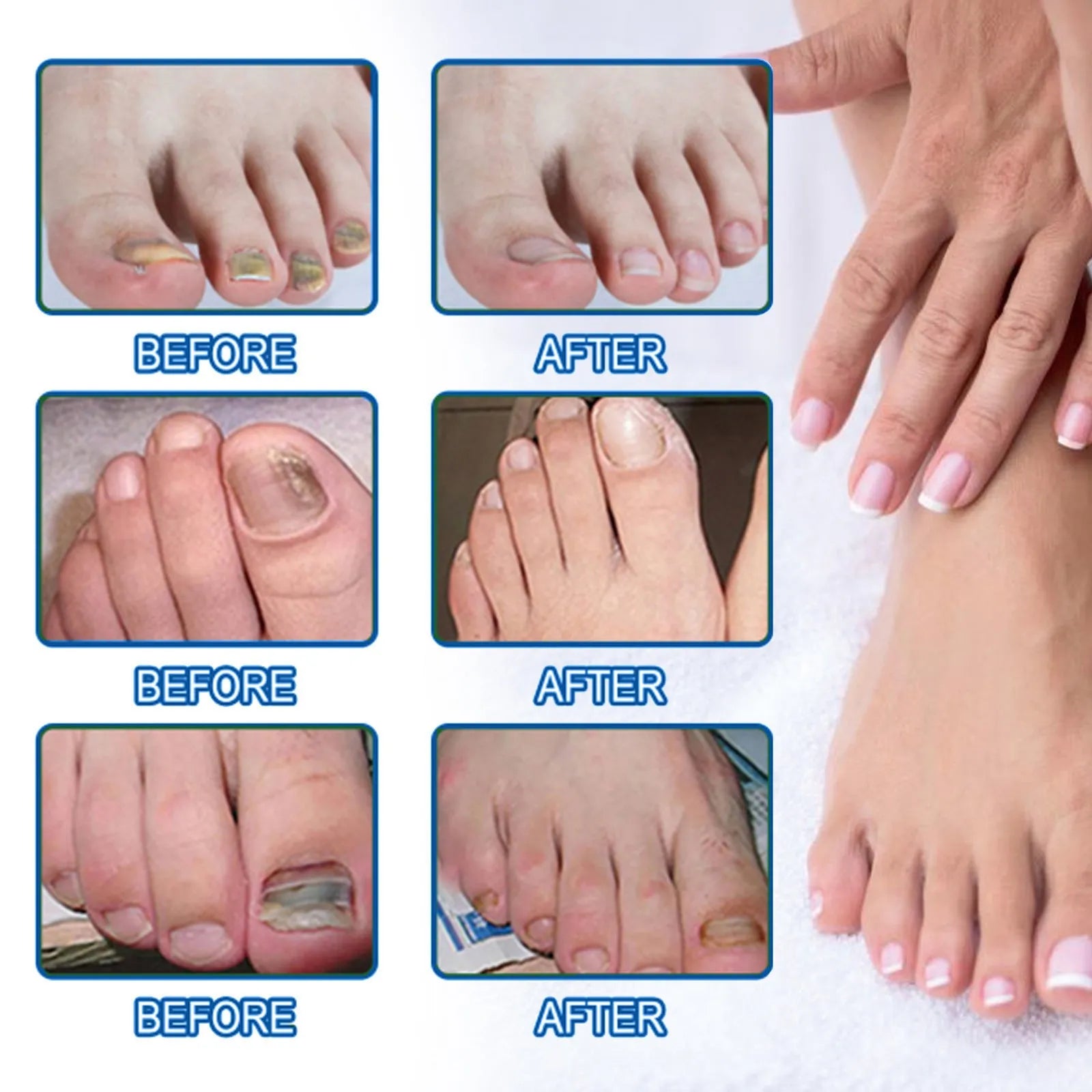 Box of 32 nail repair adhesive bandages measuring 6.1 x 3.5 cm for cracked and damaged nails
