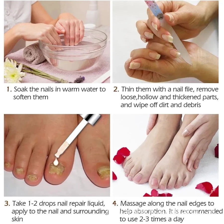 10ml Whitenail Antibacterial Liquid bottle for toenail fungus and foot odour treatment