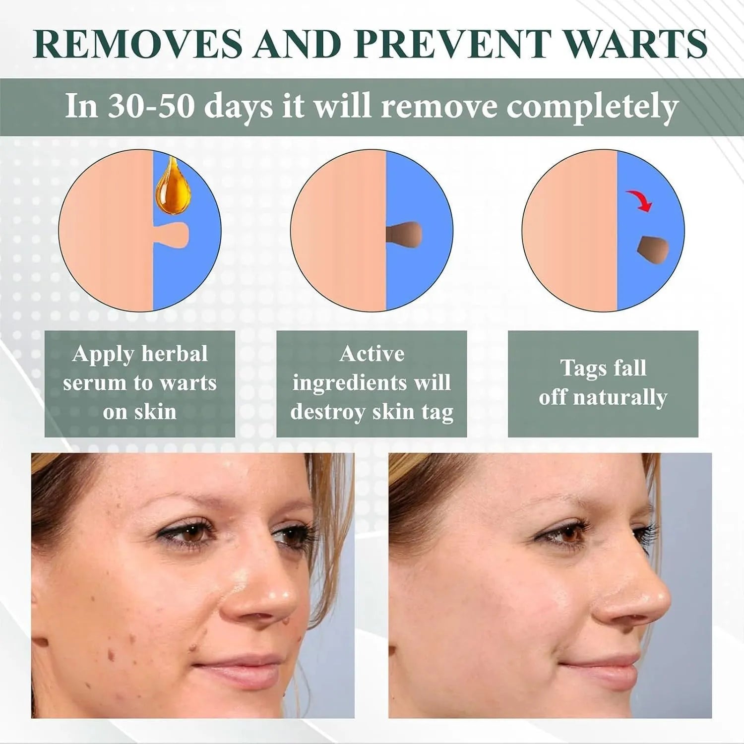 Natureerase Instant Mole Spot Removal Gel 45g tube for hydrating spot treatment