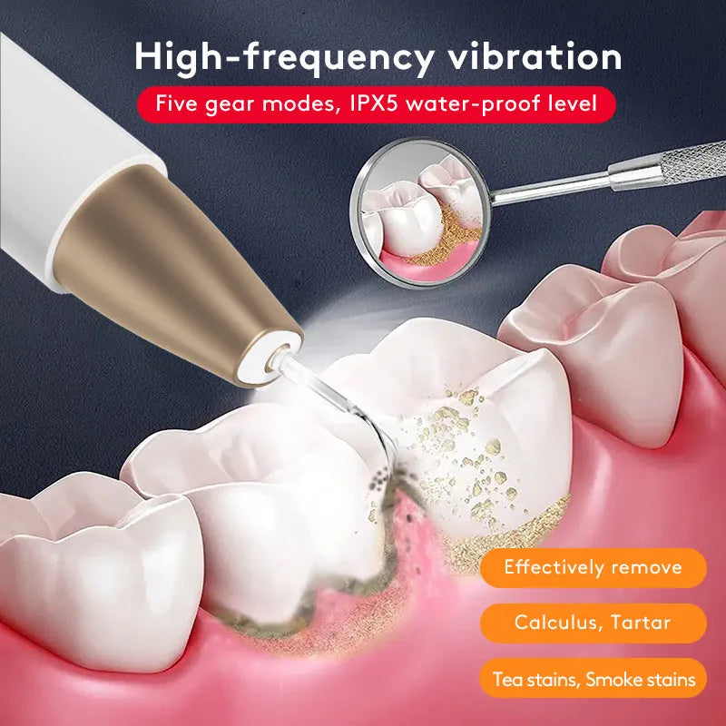 Gold ultrasonic tooth cleaning instrument for tartar removal and stain reduction