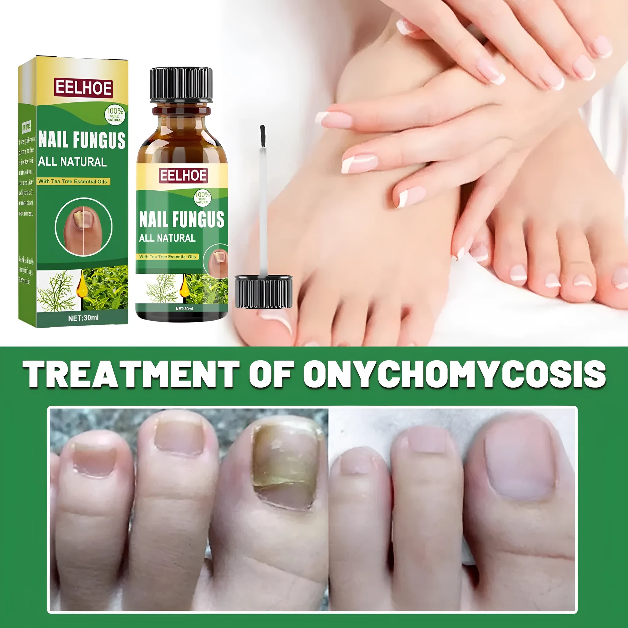 30ml bottle of tea tree oil nail repair treatment fluid for fingernails and toenails.