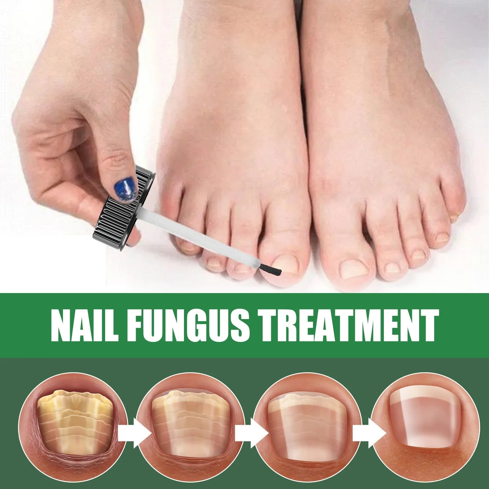 30ml bottle of tea tree oil nail repair treatment fluid for fingernails and toenails.