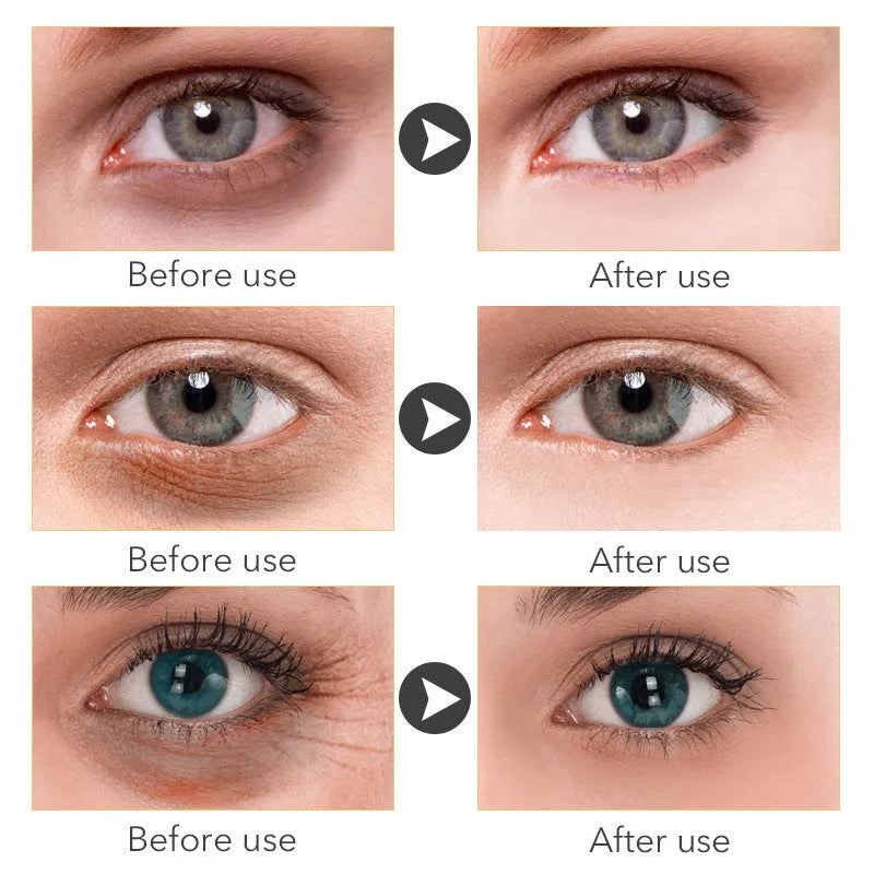 30ml tube of women's eye cream for under-eye moisturisation