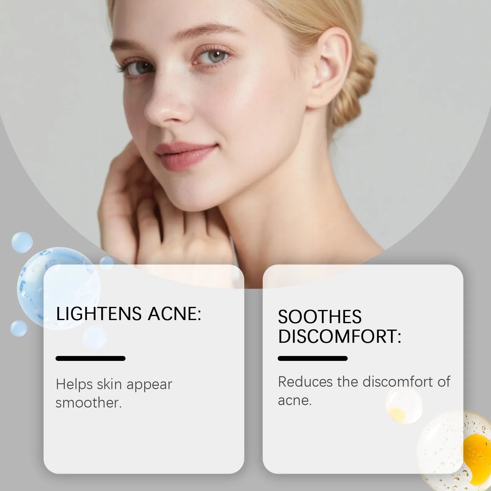 Pack of 80 hydrocolloid acne patches for facial spot treatment and blemish care