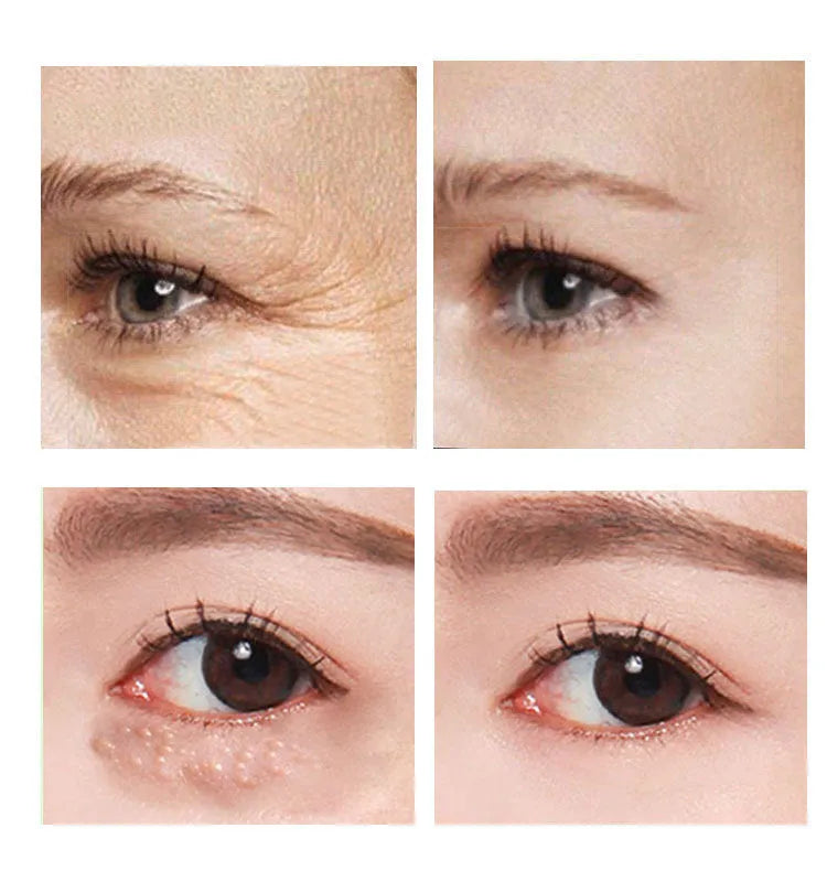 30ml tube of women's eye cream for under-eye moisturisation