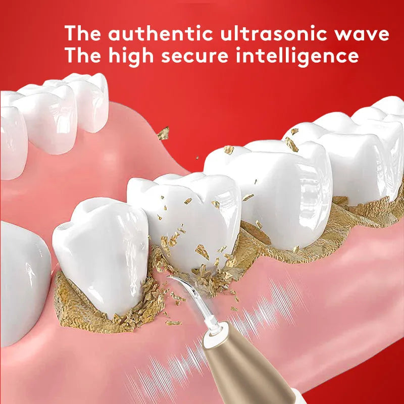 Gold ultrasonic tooth cleaning instrument for tartar removal and stain reduction